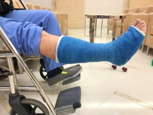 Injured patient with broken leg on fiberglass cast.